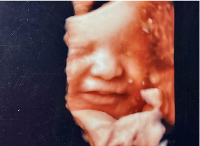 4D胎児エコー写真（36週）